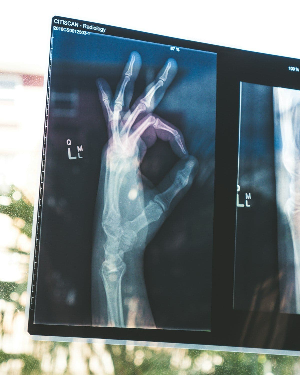 IA en el sector salud en LATAM: cómo capacitar a tu equipo en 2026